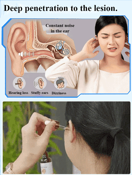 【Focus on ear health】Earwax cleaner