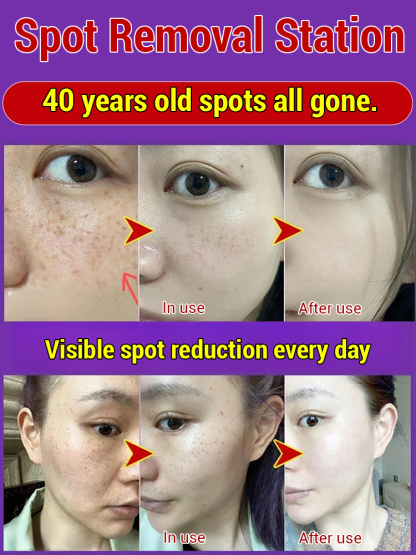 Whitening Cream with Astragalus