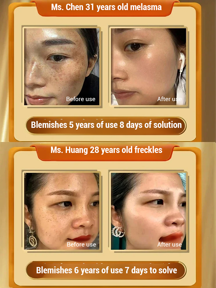 Whitening Cream with Astragalus