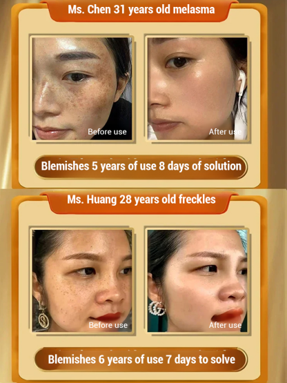 Whitening Cream with Astragalus