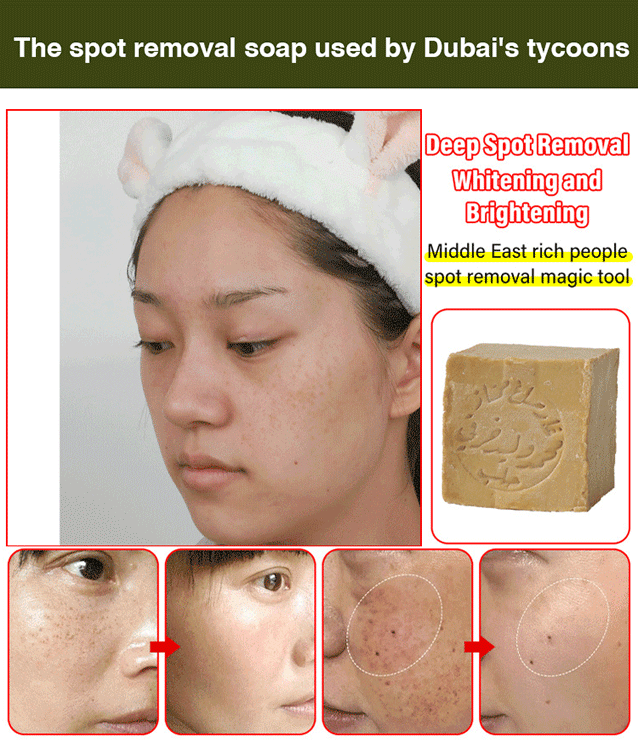 Mite and Blackhead Removal Handcrafted Ancient Soap