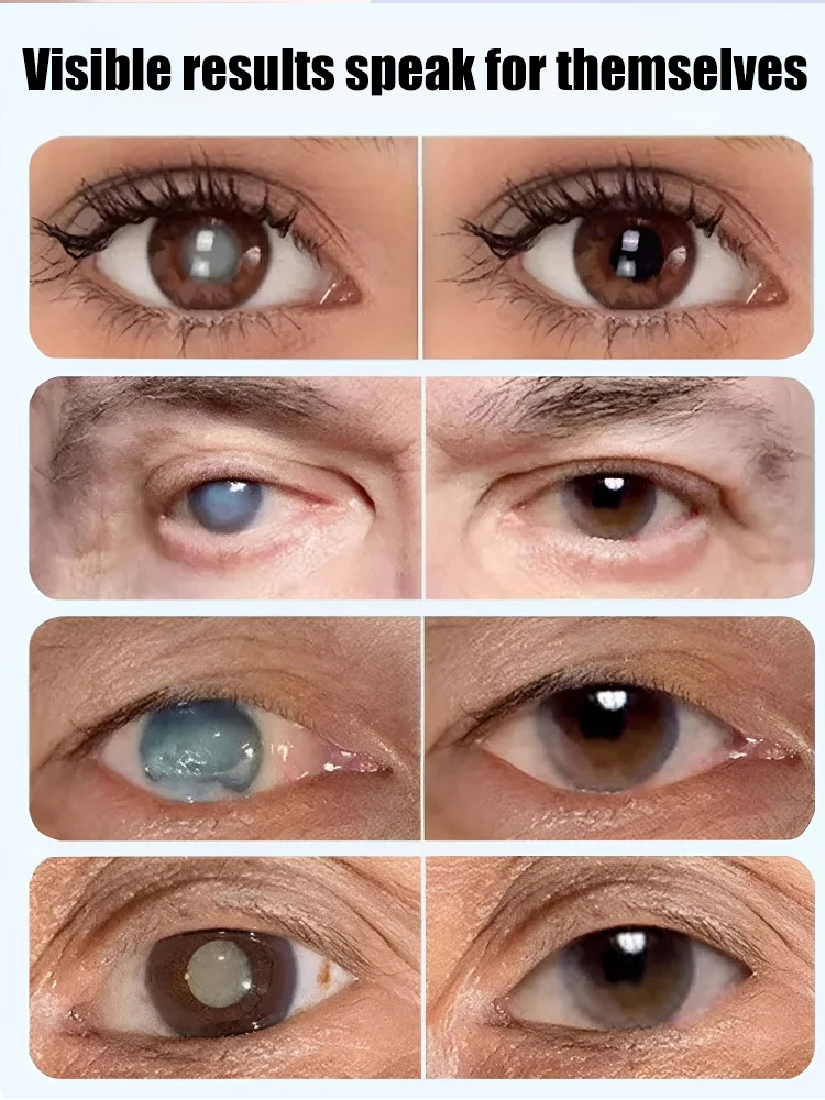 Cassia seed lutein eye drops