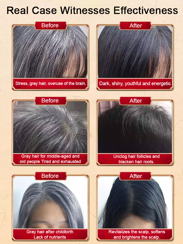 【Gray hair is gone】Black hair root black ginseng nine black tablets