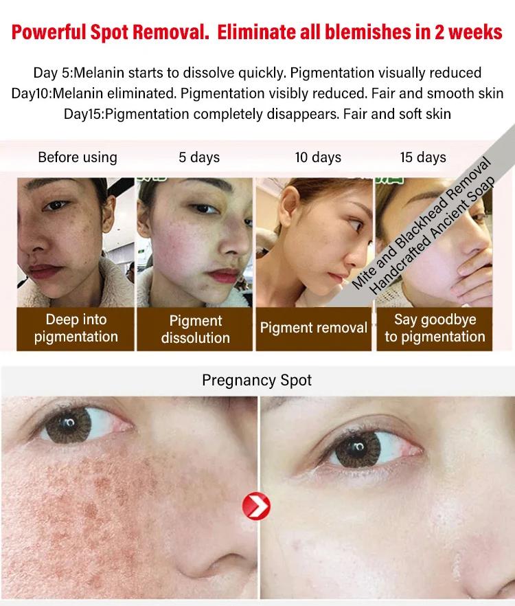 Mite and Blackhead Removal Handcrafted Ancient Soap