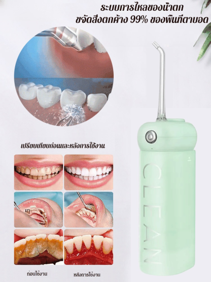 【ใช้ได้กับผู้ใส่เหล็กดัดฟัน】ไหมขัดฟันพลังน้ำอัลตราโซนิกแบบยืดหดได้
