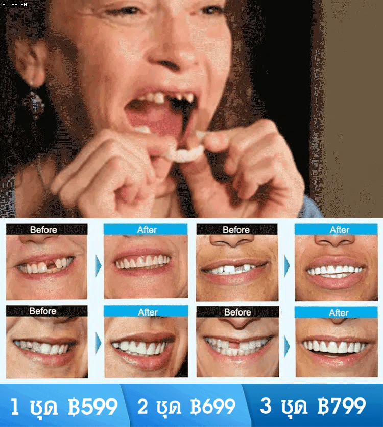 ชุดฟันปลอมรอยยิ้มสมบูรณ์แบบ