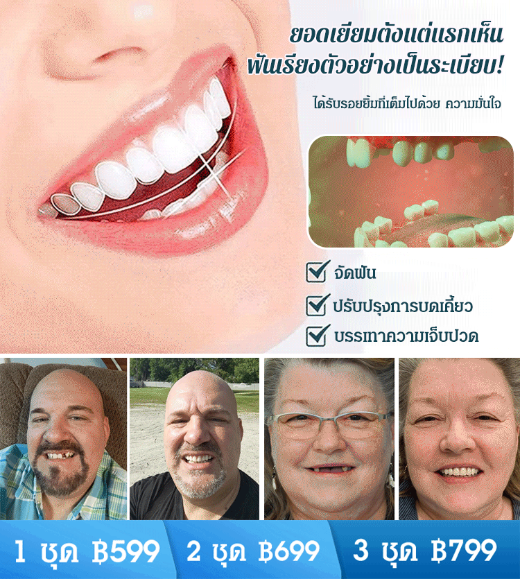 ชุดฟันปลอมรอยยิ้มสมบูรณ์แบบ
