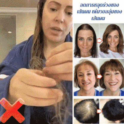 เอสเซนส์ลูกกลิ้งป้องกันผมร่วงและเสริมสร้างเส้นผม