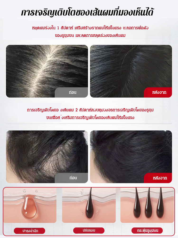 【สเปรย์พืชป้องกันผมร่วงและกระตุ้นการเจริญเติบโตของผม】