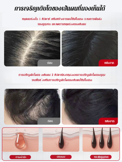 【สเปรย์พืชป้องกันผมร่วงและกระตุ้นการเจริญเติบโตของผม】