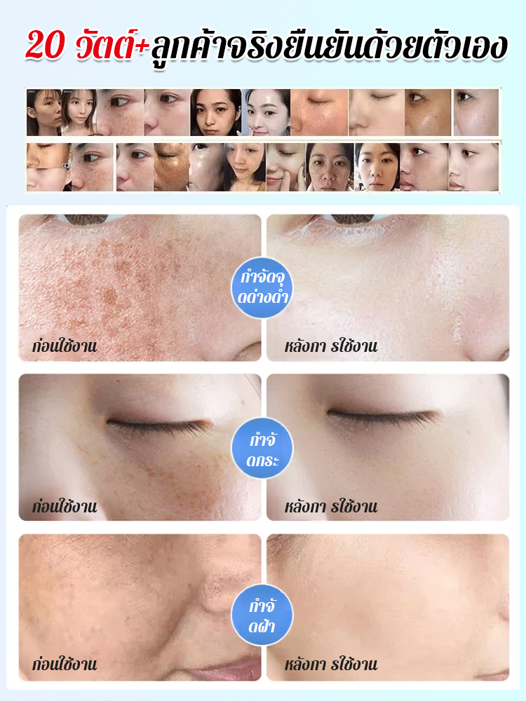 ครีมลดจุดด่างดำจากส่วนผสมธรรมชาติ