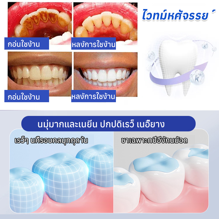 ยาสีฟันซ่อมแซมด้วยนาโนไฮดรอกซีอะพาไทต์ 7.5%