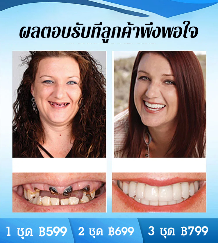 ชุดฟันปลอมรอยยิ้มสมบูรณ์แบบ