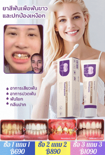 ยาสีฟันขจัดคราบเพื่อฟันขาวและปกป้องเหงือก