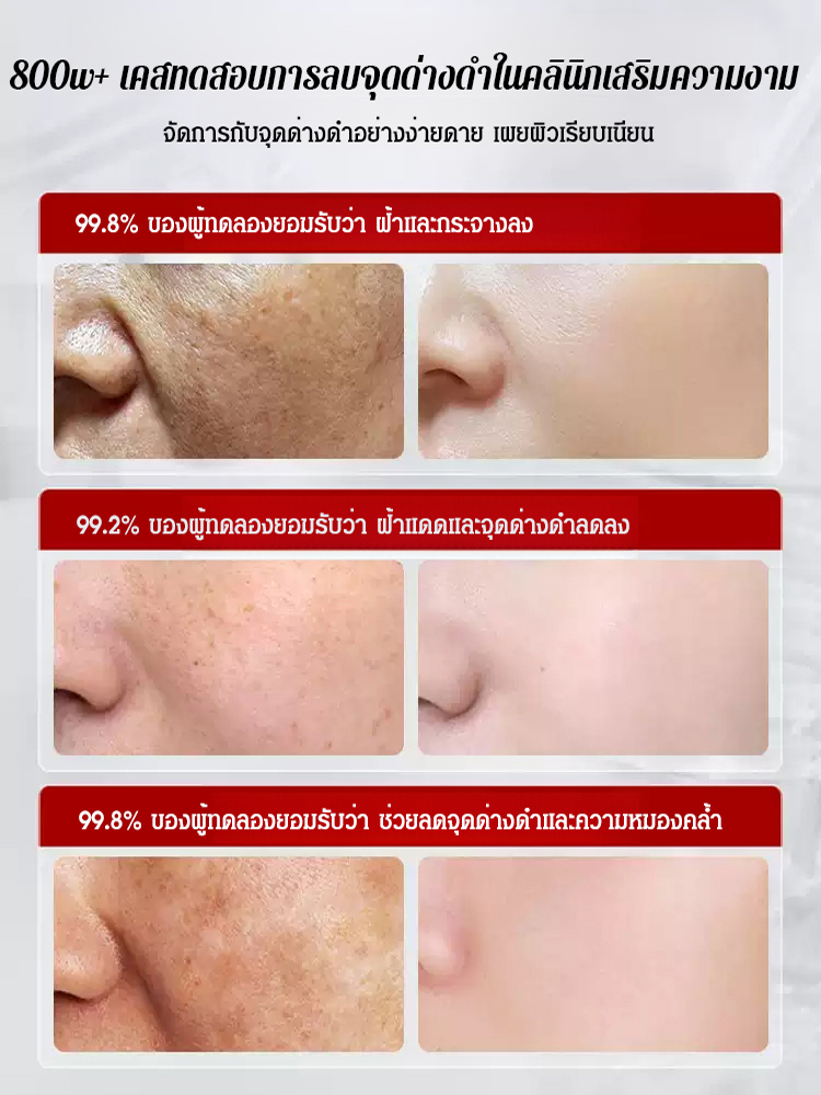 ครีม 377 ลดริ้วรอยและจุดด่างดำ บำรุงผิวขาวกระจ่างใส CKCU