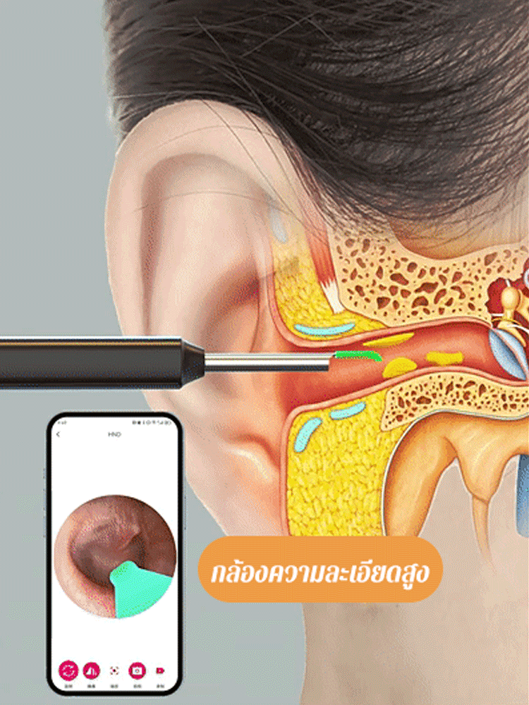 ชุดเครื่องมือแคะหูสมาร์ทมองเห็นได้