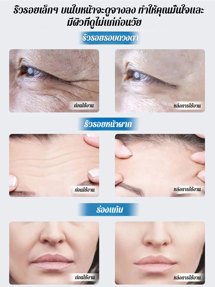 ย้อนวัยซีรั่มลดริ้วรอย