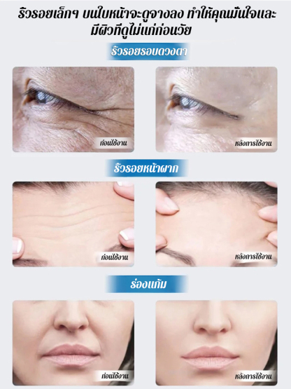 ย้อนวัยซีรั่มลดริ้วรอย
