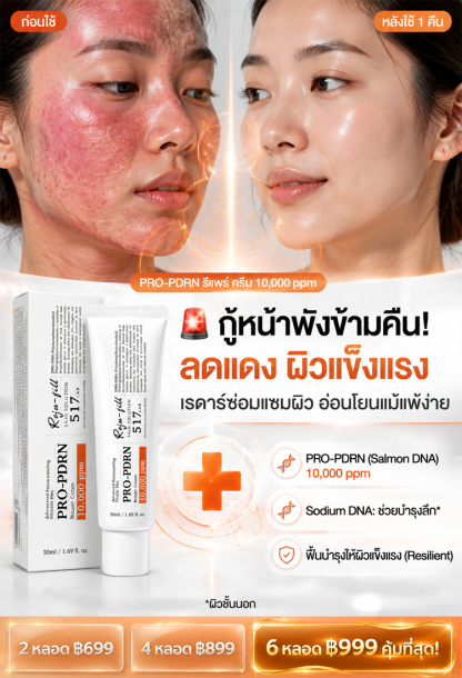 【ดูเด็กลง 10 ปี】ครีมฟื้นฟูต่อต้านริ้วรอยแบบครบวงจร 517 Baby Needle
