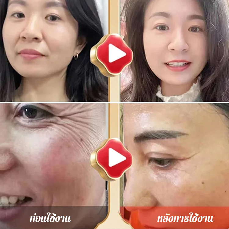 【สเปรย์น้ำแร่ย้อนวัย ลดริ้วรอยร่องแก้ม】