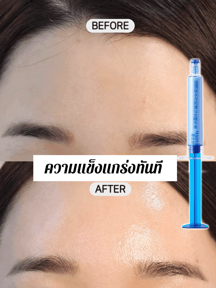 ย้อนวัยซีรั่มลดริ้วรอย