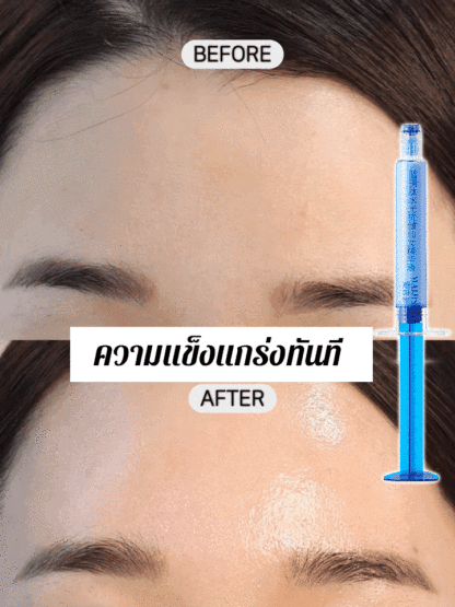 ย้อนวัยซีรั่มลดริ้วรอย