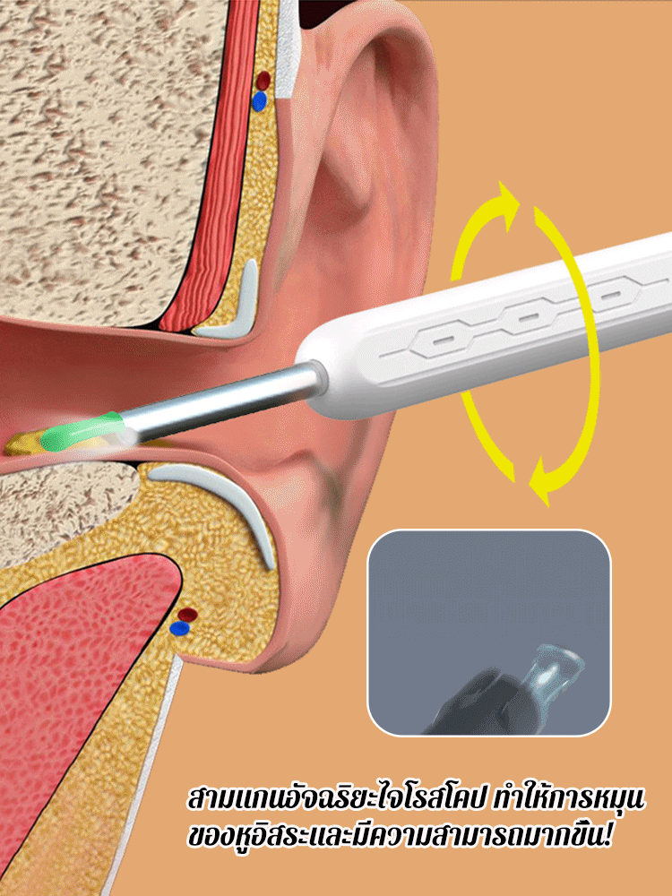 ชุดเครื่องมือแคะหูสมาร์ทมองเห็นได้
