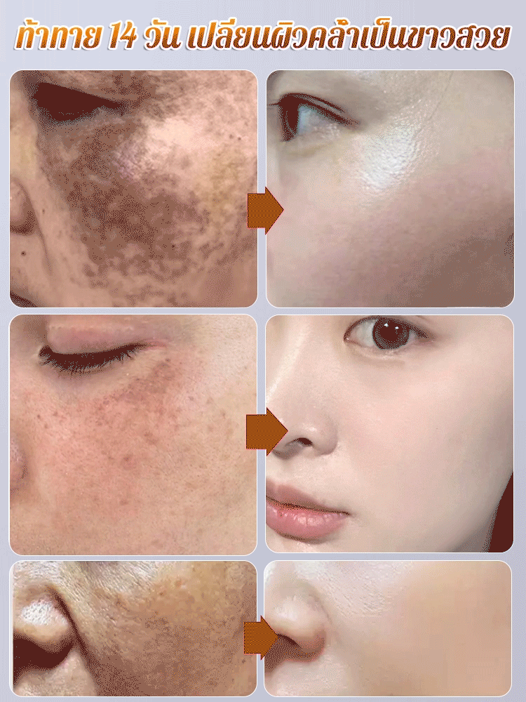 ครีม 377 ลดริ้วรอยและจุดด่างดำ บำรุงผิวขาวกระจ่างใส CKCU