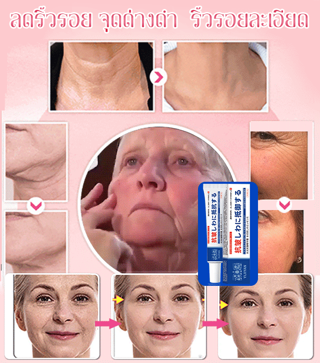 เทคโนโลยีญี่ปุ่น ครีมต่อต้านริ้วรอยให้ความชื้น