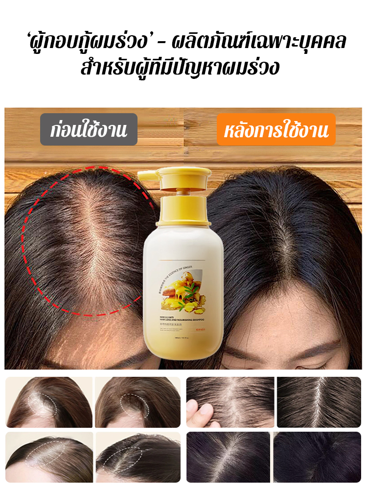 【1 แชมพูเพิ่มปริมาณสองเท่า】แชมพูป้องกันผมร่วง