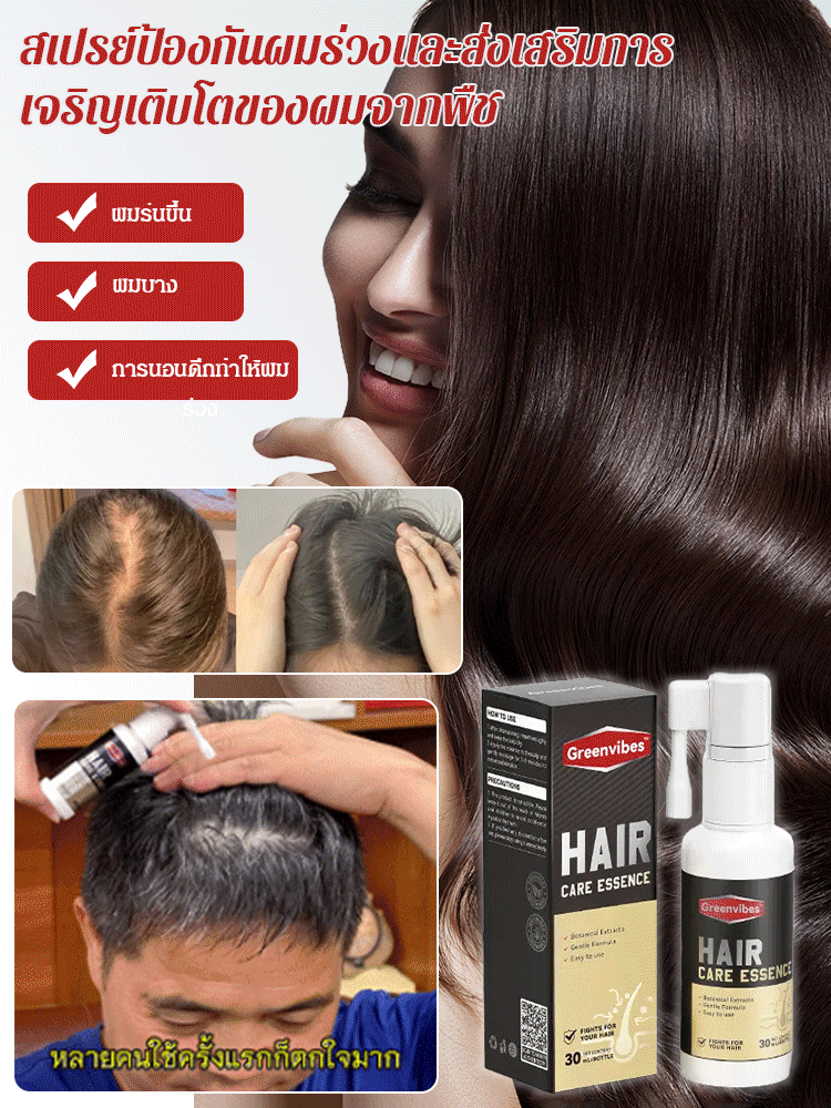 【สเปรย์พืชป้องกันผมร่วงและกระตุ้นการเจริญเติบโตของผม】