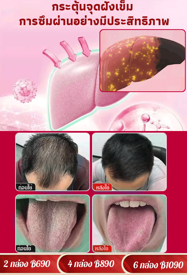 【รุ่นทรงพลัง!】แผ่นแปะบำรุงตับด้วยสารสกัดจากมิลค์ทิสเทิลและส้มมือ