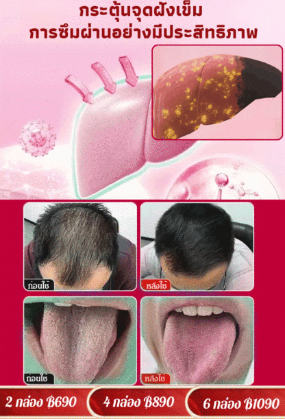 【รุ่นทรงพลัง!】แผ่นแปะบำรุงตับด้วยสารสกัดจากมิลค์ทิสเทิลและส้มมือ