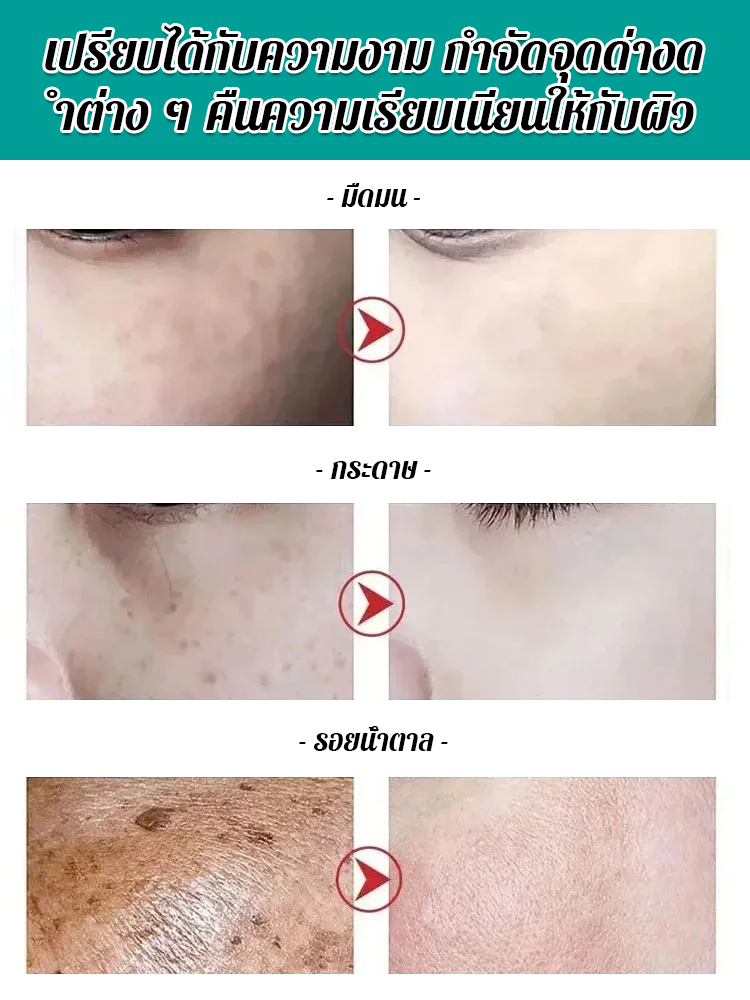 ครีมลดจุดด่างดำจากส่วนผสมธรรมชาติ