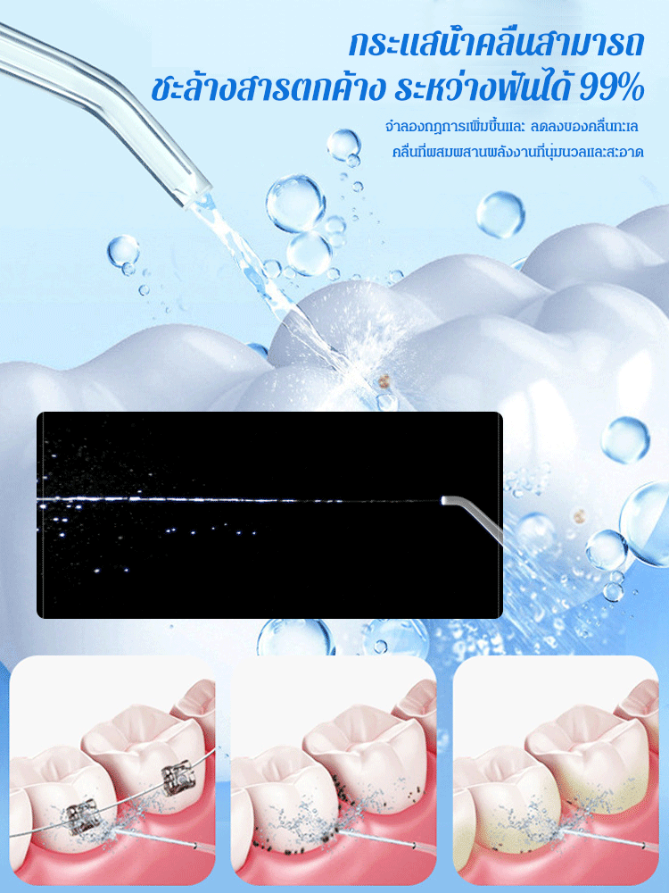 【ใช้ได้กับผู้ใส่เหล็กดัดฟัน】ไหมขัดฟันพลังน้ำอัลตราโซนิกแบบยืดหดได้