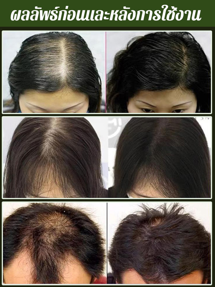 สบู่สระผมใบสนไซเปรส