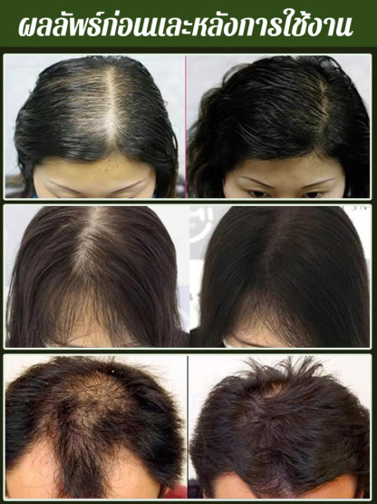 สบู่สระผมใบสนไซเปรส