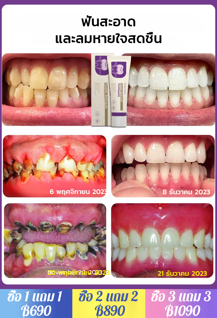 ยาสีฟันขจัดคราบเพื่อฟันขาวและปกป้องเหงือก