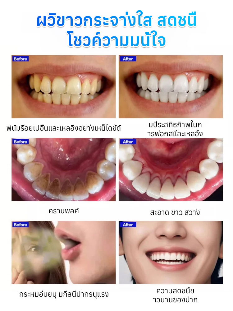 ยาสีฟันขจัดคราบเหลือง ลดกลิ่นปาก ฟันขาว