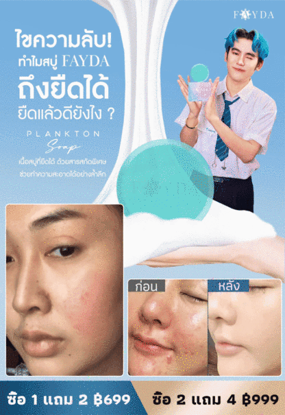 【ผิวสะอาดขาวใส】สบู่สูตรบำรุงผิวไร้ที่ติ