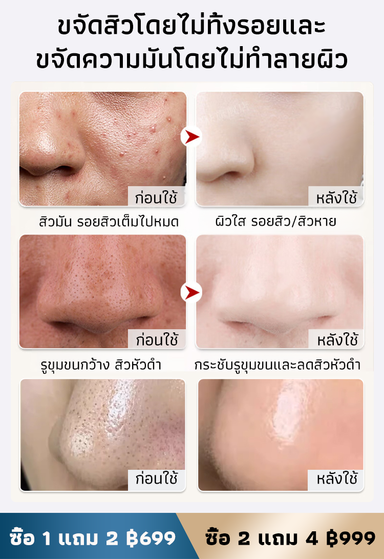 【ผิวสะอาดขาวใส】สบู่สูตรบำรุงผิวไร้ที่ติ