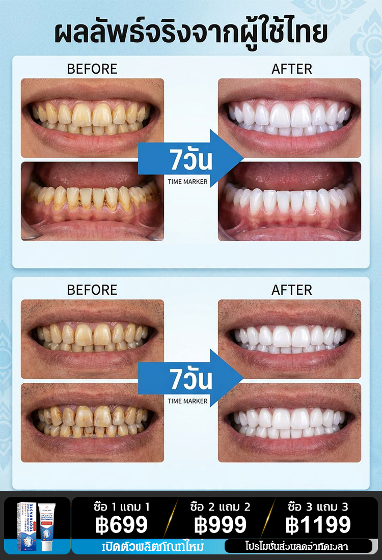 【เทคโนโลยีล้ำสมัยจากญี่ปุ่น】 ยาสีฟันสูตรป้องกันฟันผุและเพื่อฟันขาว ZK 
