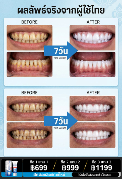 【เทคโนโลยีล้ำสมัยจากญี่ปุ่น】 ยาสีฟันสูตรป้องกันฟันผุและเพื่อฟันขาว ZK 