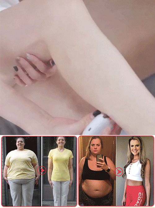 เครื่องกัวซาไฟฟ้าอัจฉริยะด้วยหินเบียน ยกกระชับใบหน้าได้