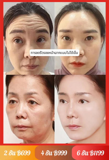 เซรั่มแซลมอนบำรุงผิวลดริ้วรอย