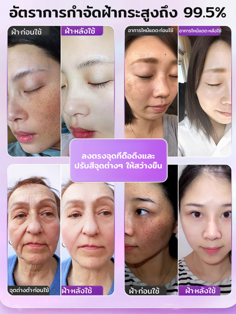 แคปซูลเสริมสารอาหารรายวัน