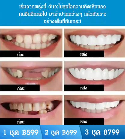 ชุดฟันปลอมรอยยิ้มสมบูรณ์แบบ