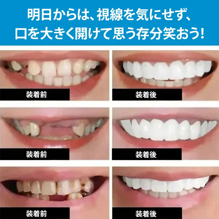 シリコン入れ歯セット