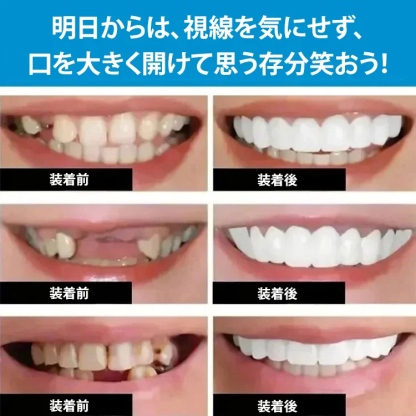 シリコン入れ歯セット