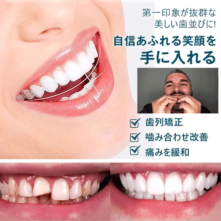 SorriBemシリコーン入れ歯